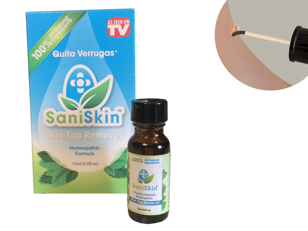 Sani Skin - натурален продукт за премахване на брадавици и папиломи